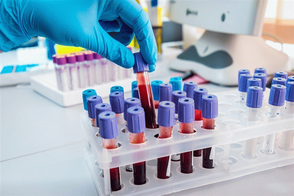 Современная медицина: что такое типирование крови?